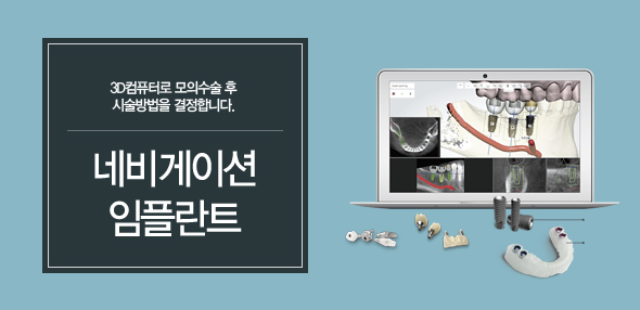 �׺���̼� ���ö�Ʈ