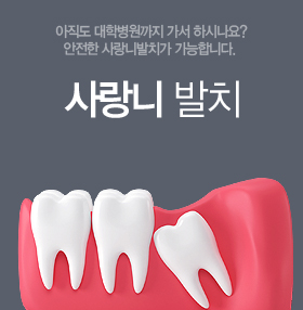 ����� ��ġ