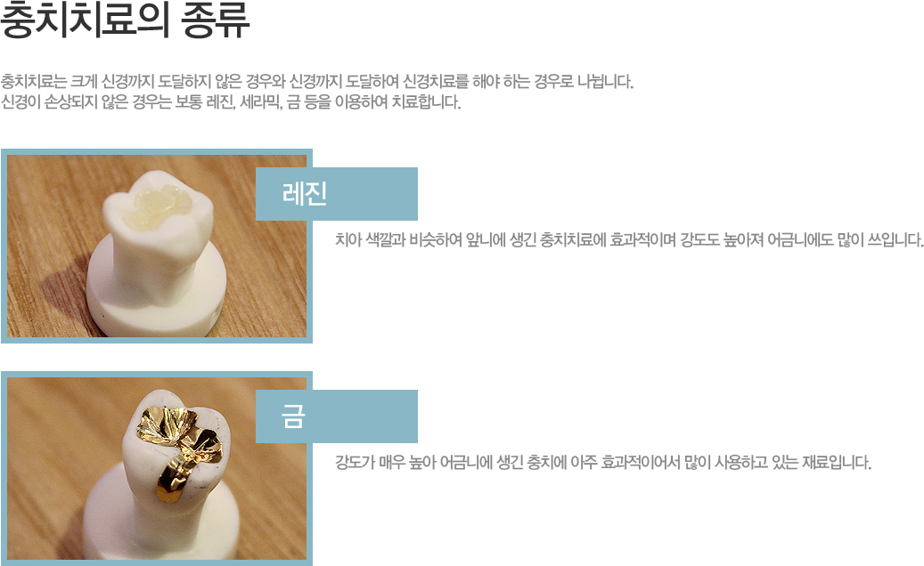 ��ġġ��� ũ�� �Ű���� �������� ���� ���� �Ű���� �����Ͽ� �Ű�ġ�Ḧ �ؾ� �ϴ� ���� �����ϴ�. 
�Ű��� �ջ���� ���� ���� ���� ����, �����, �� ���� �̿��Ͽ� ġ���մϴ�.

���� - ġ�� ����� ����Ͽ� �մϿ� ���� ��ġġ�ῡ ȿ�����̸� ������ ������ ��ݴϿ��� ���� ���Դϴ�. 
�� - ������ �ſ� ���� ��ݴϿ� ���� ��ġ�� ���� ȿ�����̾ ���� ����ϰ� �ִ� ����Դϴ�. 