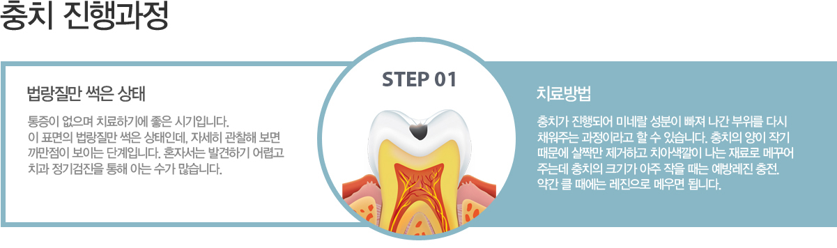 1�ܰ� : �������� ���� ���� ? ������ ������ ġ���ϱ⿡ ���� �ñ��Դϴ�. �� ǥ���� �������� ���� �����ε�, �ڼ��� ������ ���� ����� ���̴� �ܰ��Դϴ�. ȥ�ڼ��� �߰��ϱ� ��ư� ġ�� ��������� ���� �ƴ� ���� �����ϴ�.
		ġ����
		1�ܰ� : ��ġ�� ����Ǿ� �̳׶� ������ ���� ���� ������ �ٽ� ä���ִ� �����̶�� �� �� �ֽ��ϴ�. ��ġ�� ���� �۱� ������ ��¦�� �����ϰ� ġ�ƻ����� ���� ���� �޲پ� �ִµ� ��ġ�� ũ�Ⱑ ���� ���� ���� ���淹�� ����. �ణ Ŭ ������ �������� �޿�� �˴ϴ�.
