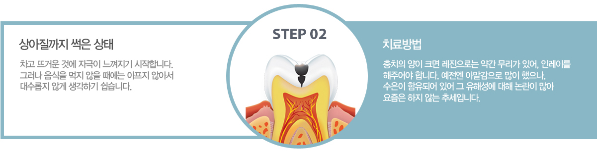 2�ܰ� : ��������� ���� ���� ? ���� �߰ſ� �Ϳ� �ڱ��� �������� �����մϴ�. �׷��� ������ ���� ���� ������ ������ �ʾƼ� ������� �ʰ� �����ϱ� �����ϴ�.
		ġ����
		2�ܰ� : ��ġ�� ���� ũ�� �������δ� �ణ ������ �־�, �η��̸� ���־�� �մϴ�. ������ �Ƹ������� ���� ������, ������ �����Ǿ� �־� �� ���ؼ��� ���� ������ ���� ������ ���� �ʴ� �߼��Դϴ�.