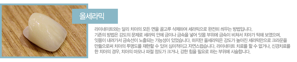 �ü����
��̳���Ʈ�ʹ� �޸� ġ���� ��� ���� ����� �����Ͽ� ��������� ������ ����� ����Դϴ�. 
������ ����� ������ ������ ����� �ȿ� ���̳� �ݼ��� �־� �ո� ������ �ݼ��� ���ļ� ġ�ư� Ź�� ��������, �ո��� �������� �ݼӼ��� ����Ǵ� ���ɼ��� �־����ϴ�. ������ �ü������ ������ ������ ����͸����� ũ����� �������ν� ġ���� �������� ������ �� �־� �ɹ����̰� �ڿ��������ϴ�.
��̳���Ʈ ġ�Ḧ �� �� ���ų�, �Ű�ġ�Ḧ �� ġ���� ���, ġ���� ���� ���� ������ ũ�ų�, ���� ���� �ʿ�� �ϴ� ������ �ü��մϴ�. 
