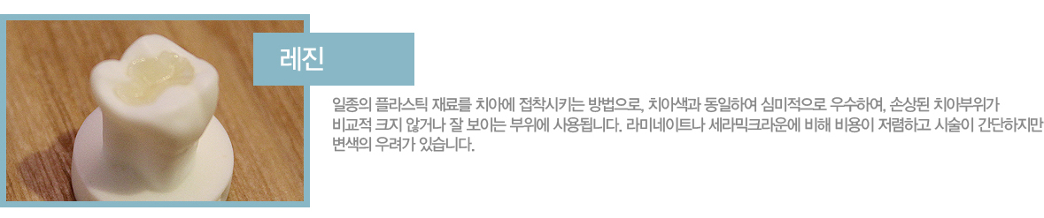 ����
������ �ö�ƽ ��Ḧ ġ�ƿ� ������Ű�� �������, ġ�ƻ��� �����Ͽ� �ɹ������� ����Ͽ�, �ջ�� ġ�ƺ����� ���� ũ�� �ʰų� �� ���̴� ������ ���˴ϴ�.
��̳���Ʈ�� �����ũ�� ���� ����� �����ϰ� �ü��� ���������� ������ ����� �ֽ��ϴ�. 