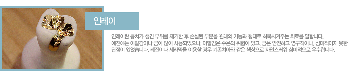 �η���
�η��̶� ��ġ�� ���� ������ ������ �� �սǵ� �κ��� ������ ��ɰ� ���·� ȸ�������ִ� ġ�Ḧ ���մϴ�.
�������� �Ƹ����̳� ���� ���� ���Ǿ�����, �Ƹ����� ������ ������ �ְ�, ���� �����ϰ� �������̳�, �ɹ������� ���� ������ �־����ϴ�.
�����̳� ������� �̿��� ��� ����ġ�ƿ� ���� �������� �ڿ������� �ɹ������� ����մϴ�. 