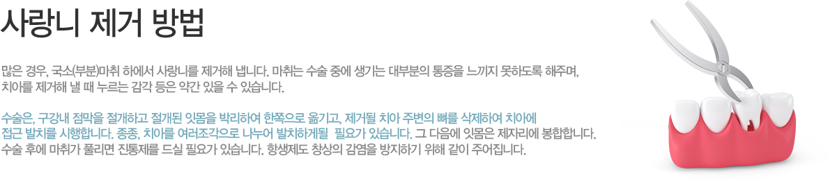 < ����� ���� ��� >

���� ���, ����(�κ�)���� �Ͽ��� ����ϸ� ������ ���ϴ�. ����� ���� �߿� ����� ��κ��� ������ ������ ���ϵ��� ���ָ�, ġ�Ƹ� ������ �� �� ������ ���� ���� �ణ ���� �� �ֽ��ϴ�. ������, ������ ������ �����ϰ� ������ �ո��� �ڸ��Ͽ� �������� �ű��, ���ŵ� ġ�� �ֺ��� ���� �����Ͽ� ġ�ƿ� ���� ��ġ�� �����մϴ�. ����, ġ�Ƹ� ������������ ������ ��ġ�ϰԵ�  �ʿ䰡 �ֽ��ϴ�. �� ������ �ո��� ���ڸ��� �����մϴ�.
���� �Ŀ� ���밡 Ǯ���� �������� ��� �ʿ䰡 �ֽ��ϴ�. �׻����� â���� ������ �����ϱ� ���� ���� �־����ϴ�. 
