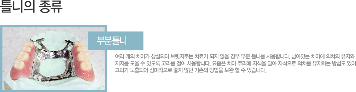 �κ�Ʋ��

���� ���� ġ�ư� ��ǵǾ� �긴���δ� ġ�ᰡ ���� ���� ��� �κ� Ʋ�ϸ� ����մϴ�. �����ִ� ġ�ƿ� ��ġ�� ������ ������ ���� �� �ֵ��� ������ �ɾ� ����մϴ�. ������ ġ�� �Ѹ��� �ڼ��� �޾� �ڼ����� ��ġ�� �����ϴ� ����� �־� ������ ����Ǿ� �ɹ������� ���� �ʴ� ������ ����� ���� �� �� �ֽ��ϴ�.
