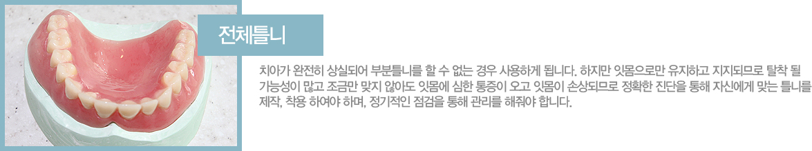 ��üƲ��

ġ�ư� ������ ��ǵǾ� �κ�Ʋ�ϸ� �� �� ���� ��� ����ϰ� �˴ϴ�. ������ �ո����θ� �����ϰ� �����ǹǷ� Ż�� �� ���ɼ��� ���� ���ݸ� ���� �ʾƵ� �ո��� ���� ������ ���� �ո��� �ջ�ǹǷ� ��Ȯ�� ������ ���� �ڽſ��� �´� Ʋ�ϸ� ����, ���� �Ͽ��� �ϸ�, �������� ������ ���� ������ ����� �մϴ�.
