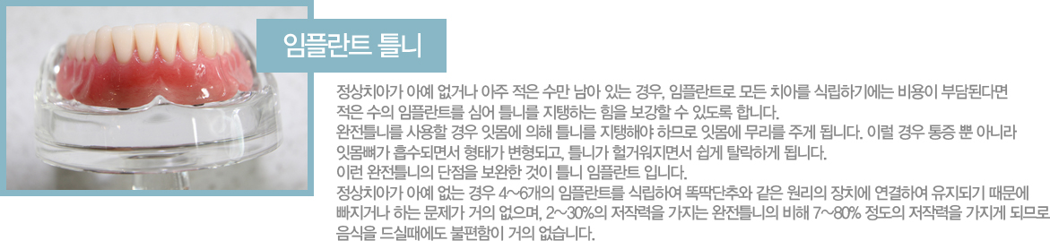 ���ö�Ʈ Ʋ��

����ġ�ư� �ƿ� ���ų� ���� ���� ���� ���� �ִ� ���, ���ö�Ʈ�� ��� ġ�Ƹ� �ĸ��ϱ⿡�� ����� �δ�ȴٸ� ���� ���� ���ö�Ʈ�� �ɾ� Ʋ�ϸ� �����ϴ� ���� ������ �� �ֵ��� �մϴ�. ����Ʋ�ϸ� ����� ��� �ո��� ���� Ʋ�ϸ� �����ؾ� �ϹǷ� �ո��� ������ �ְ� �˴ϴ�. �̷� ��� ���� �� �ƴ϶� �ո����� �����Ǹ鼭 ���°� �����ǰ�, Ʋ�ϰ� ��ſ����鼭 ���� Ż���ϰ� �˴ϴ�. 
�̷� ����Ʋ���� ������ ������ ���� Ʋ�� ���ö�Ʈ �Դϴ�.
����ġ�ư� �ƿ� ���� ��� 4~6���� ���ö�Ʈ�� �ĸ��Ͽ� �ȵ����߿� ���� ������ ��ġ�� �����Ͽ� �����Ǳ� ������ �����ų� �ϴ� ������ ���� ������, 2~30%�� ���۷��� ������ ����Ʋ���� ���� 7~80% ������ ���۷��� ������ �ǹǷ� ������ ��Ƕ����� �������� ���� �����ϴ�.

